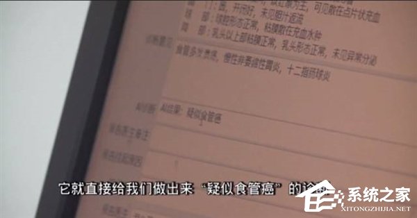 腾讯推出AI医学影像产品“腾讯觅影”：癌症早发现早治愈